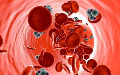 Hyperglycemia & Insulin Resistance(Diabetese)